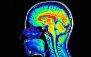 Més informació sobre l'article Existeix deterioració cognitiva associada al consum de drogues?