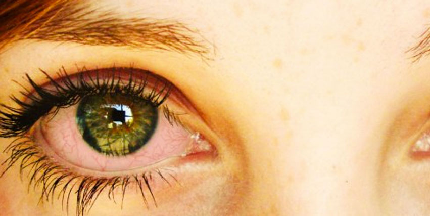 Actualment esteu veient Com actua el cànnabis al cervell?